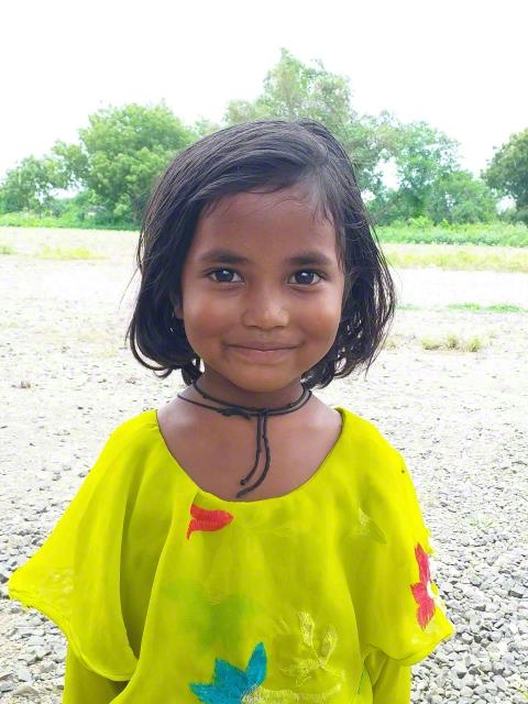 World Vision India